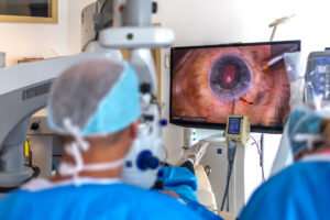 Operacja zaćmy w Czechach – opinie pacjentów i przebieg leczenia